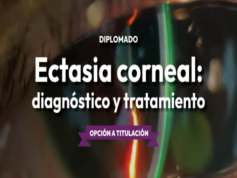 EctasiaCorneal fesi 2024