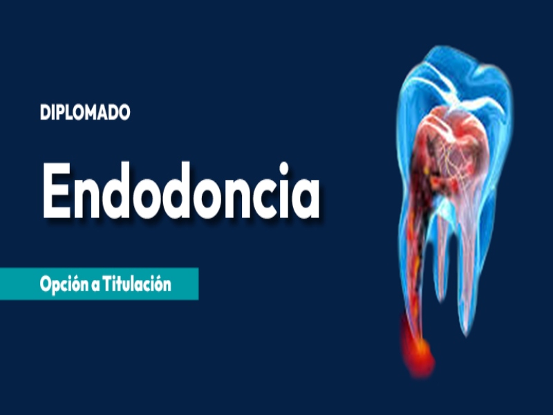 EndodonciaDip fesi 2024