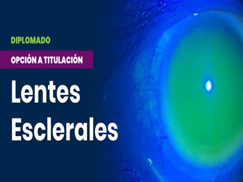 Lentes fesi 2024