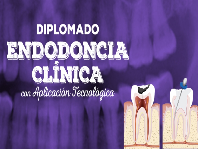 endodoncia fesi 2024
